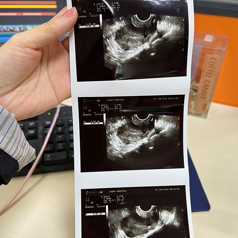 High Gloss Medical Grade Upp-110hg Sony Thermal Paper